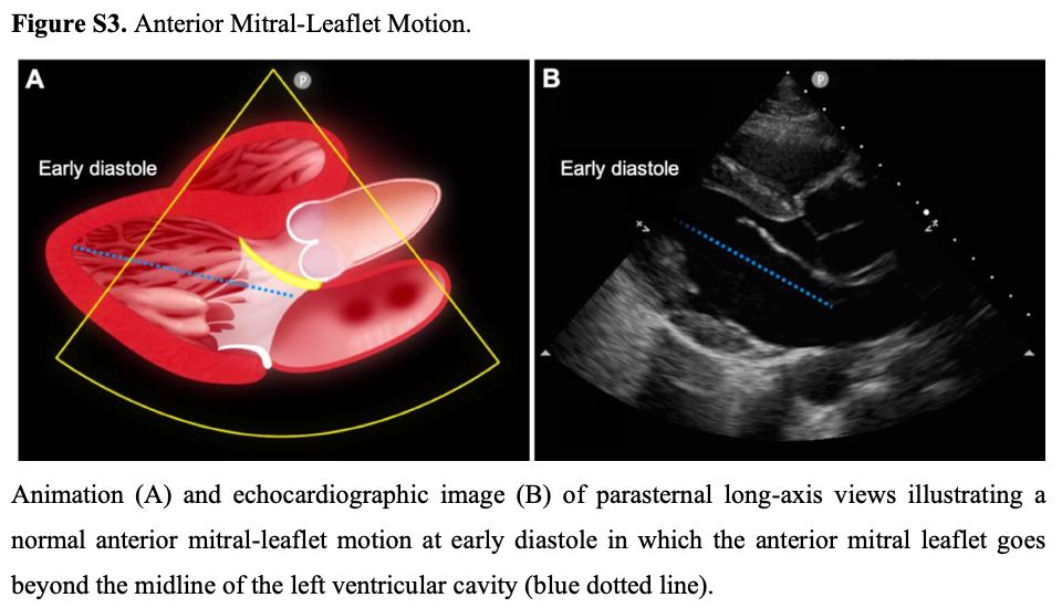 Focused Cardiac Ultrasonography for Left Ventricular Systolic Function