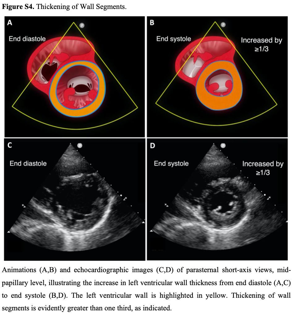 Focused Cardiac Ultrasonography for Left Ventricular Systolic Function
